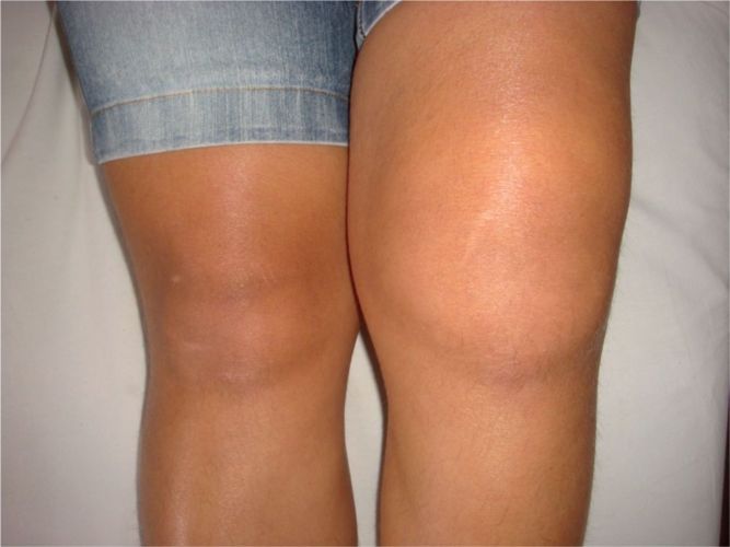 Susana, de Córdoba, fue sana de dolores e inflamaciones